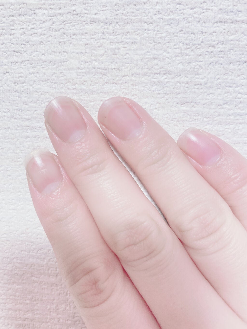 オイルジェルトリートメント/ネイルネイル/ネイルオイル・トリートメントを使ったクチコミ(4枚目)