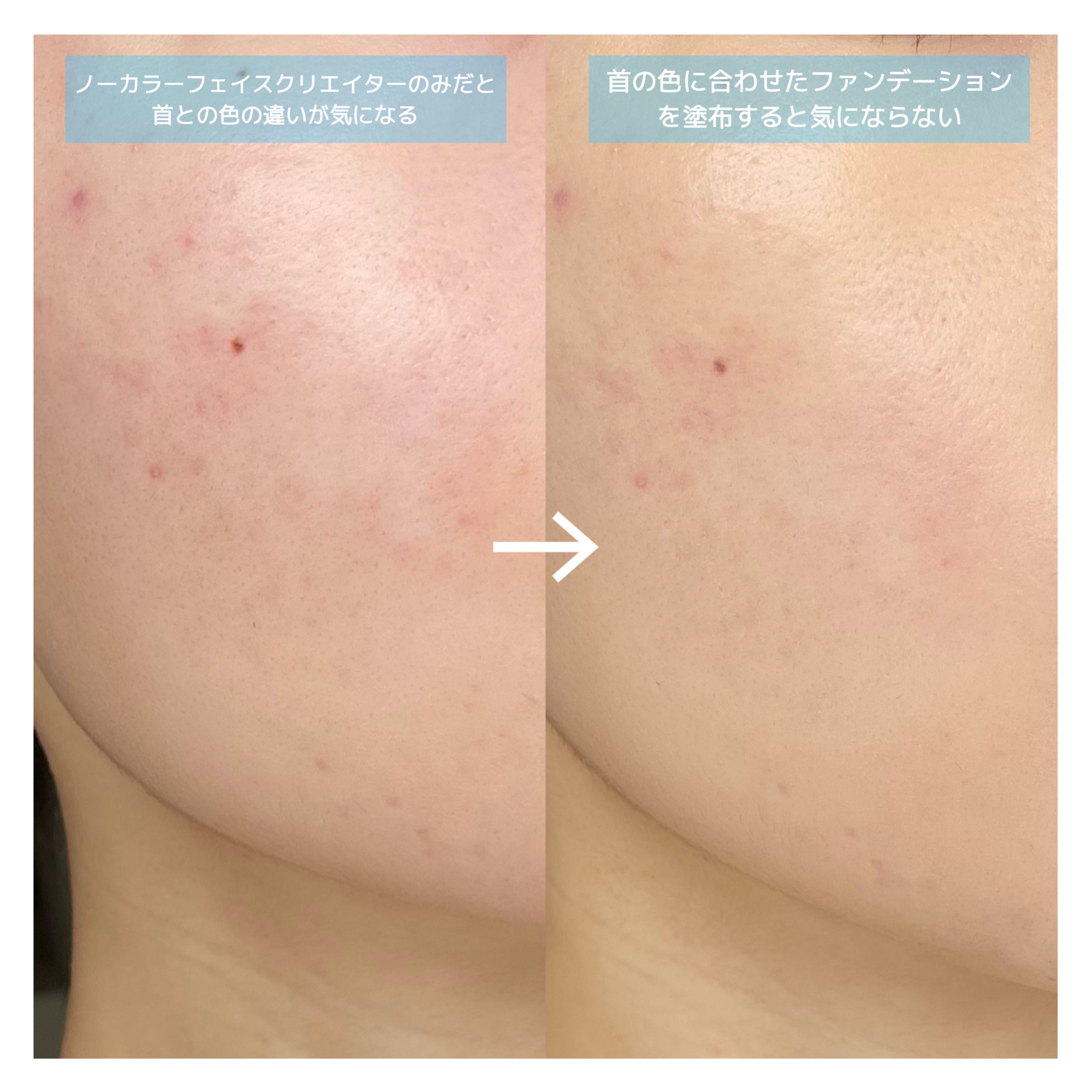 ノーカラーフェイスクリエイター/UNO/BBクリームを使ったクチコミ（3枚目）