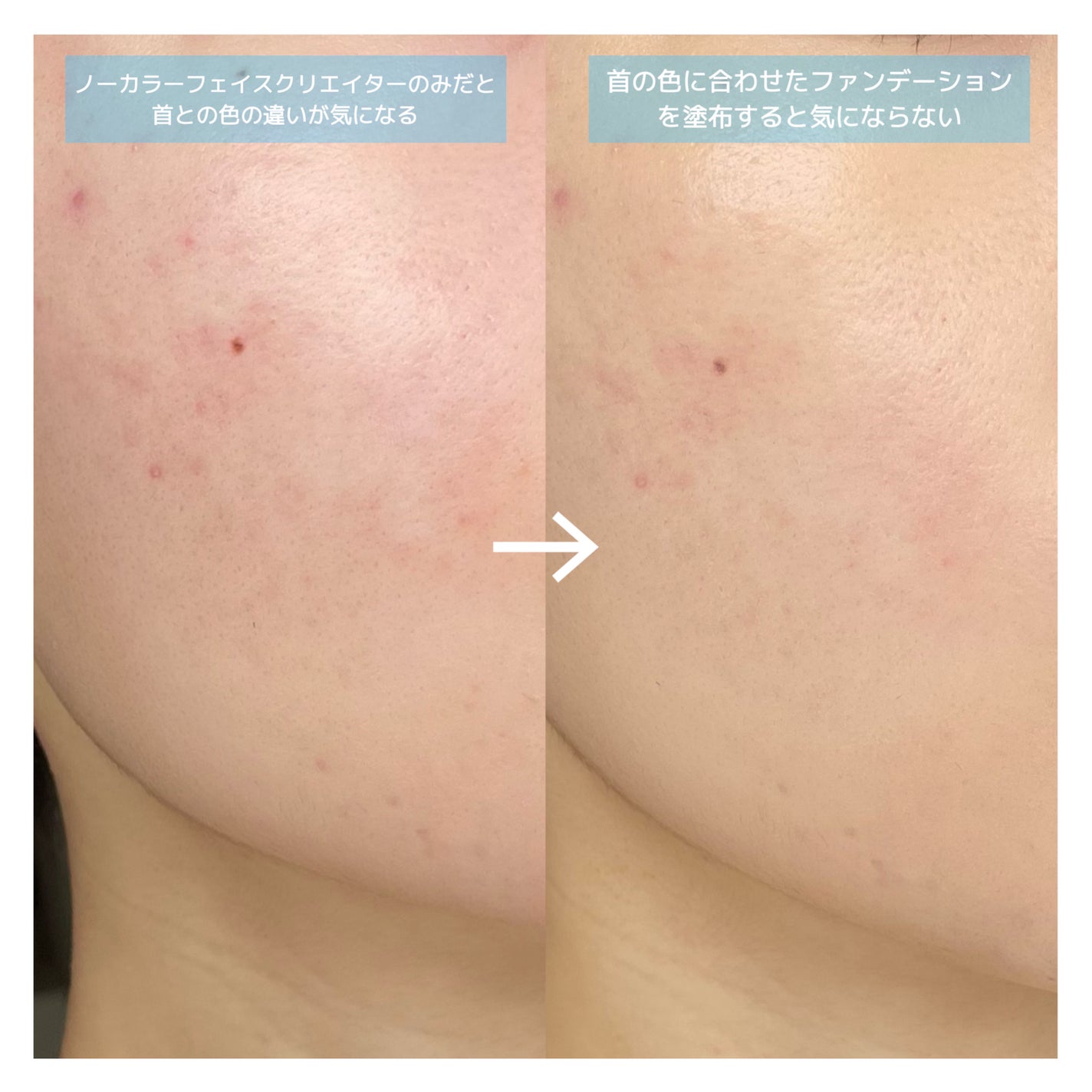 ノーカラーフェイスクリエイター/UNO/BBクリームを使ったクチコミ(3枚目)