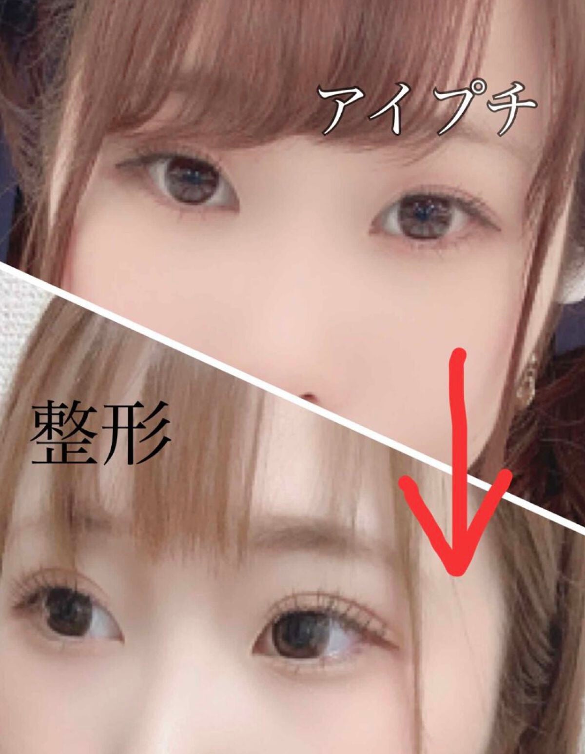 アイビューティー フィクサー WP/アストレア ヴィルゴ/二重まぶた用アイテムを使ったクチコミ(1枚目)