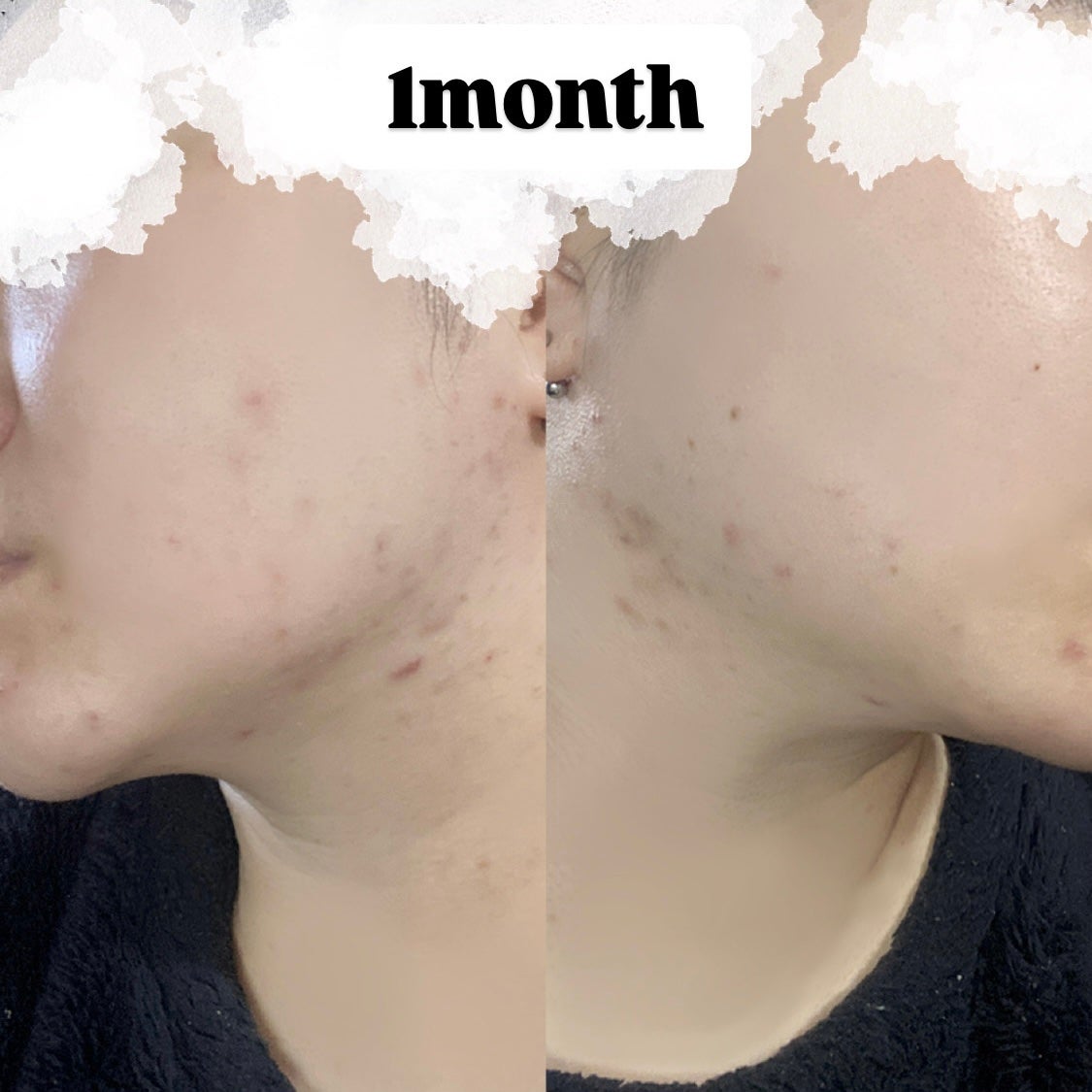 ãã¢ã¢ã¯ãã¯ãªãŒã W(å»è¬å)/ãã¢/ãã®ä»ã䜿ã£ãã¯ãã³ãïŒ3æç®ïŒ