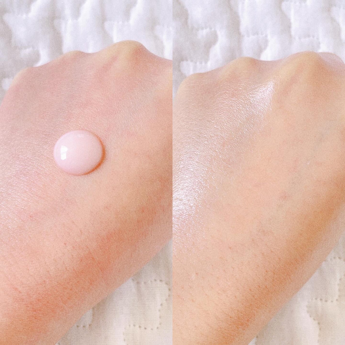 リデンス チェリートーン&スポットコレクターアンプル/redence/美容液を使ったクチコミ(2枚目)