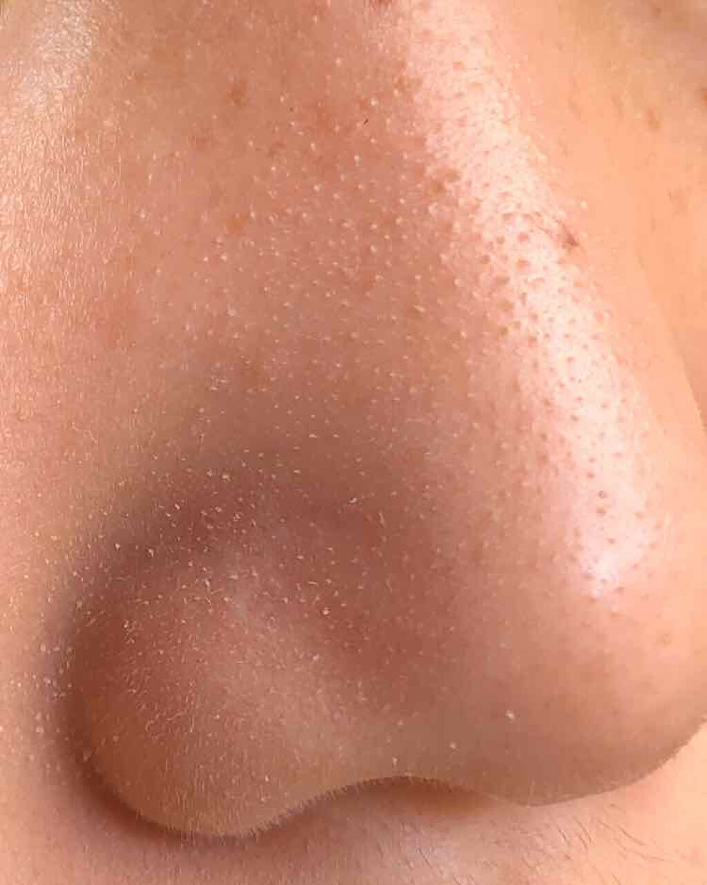 DETクリア ブライト&ピール ピーリングジェリー <ミックスベリーの香り>/Detclear/ピーリングを使ったクチコミ(3枚目)