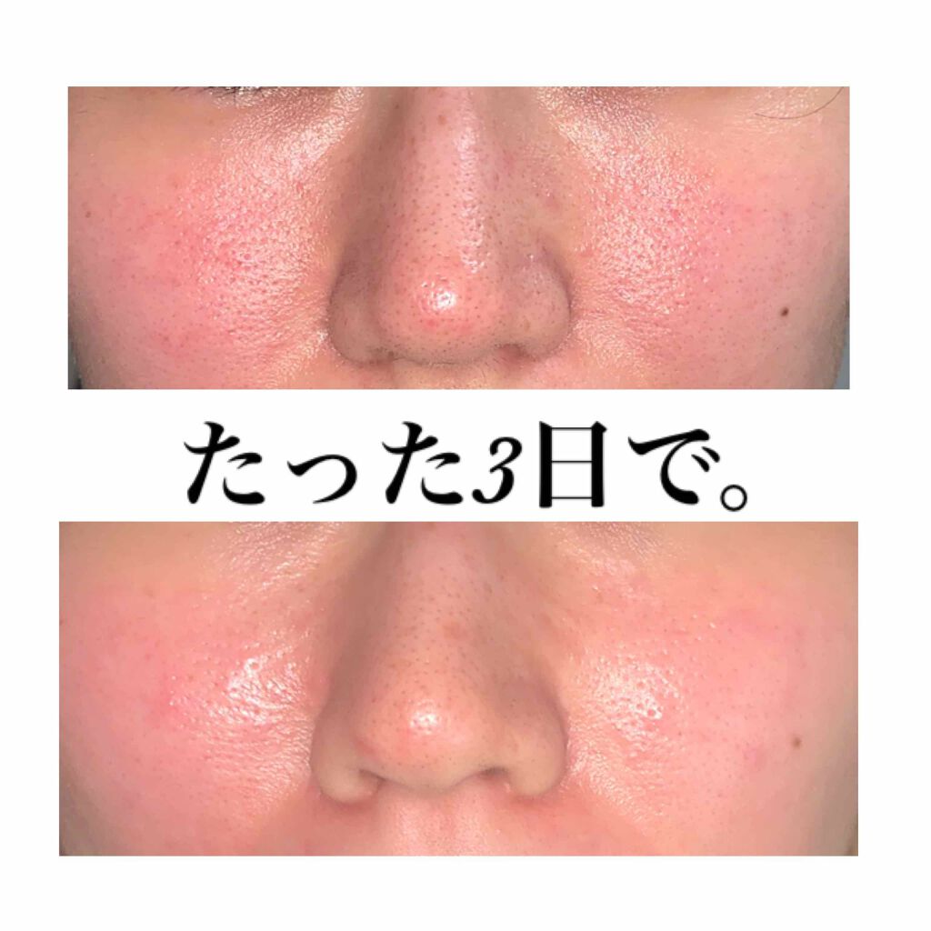 極潤プレミアム ヒアルロン液(旧)/肌ラボ/化粧水を使ったクチコミ(4枚目)