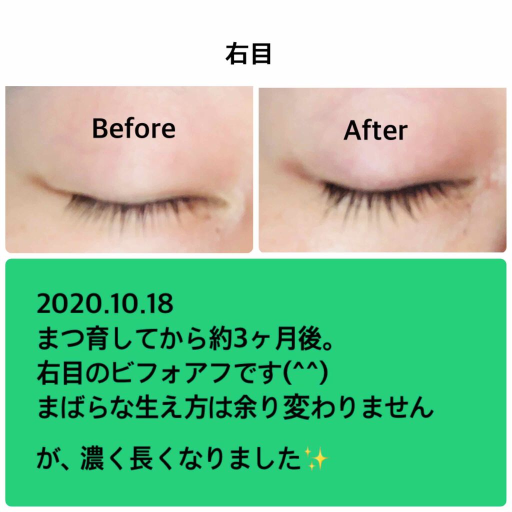 エグータム/アルマダスタイル/まつげ美容液を使ったクチコミ（2枚目）