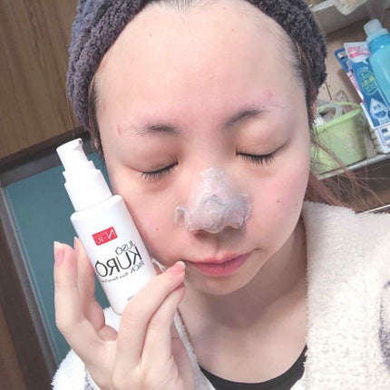 JUSO KURO PACK/NAKUNA-RE/洗い流すパック・マスクを使ったクチコミ(2枚目)