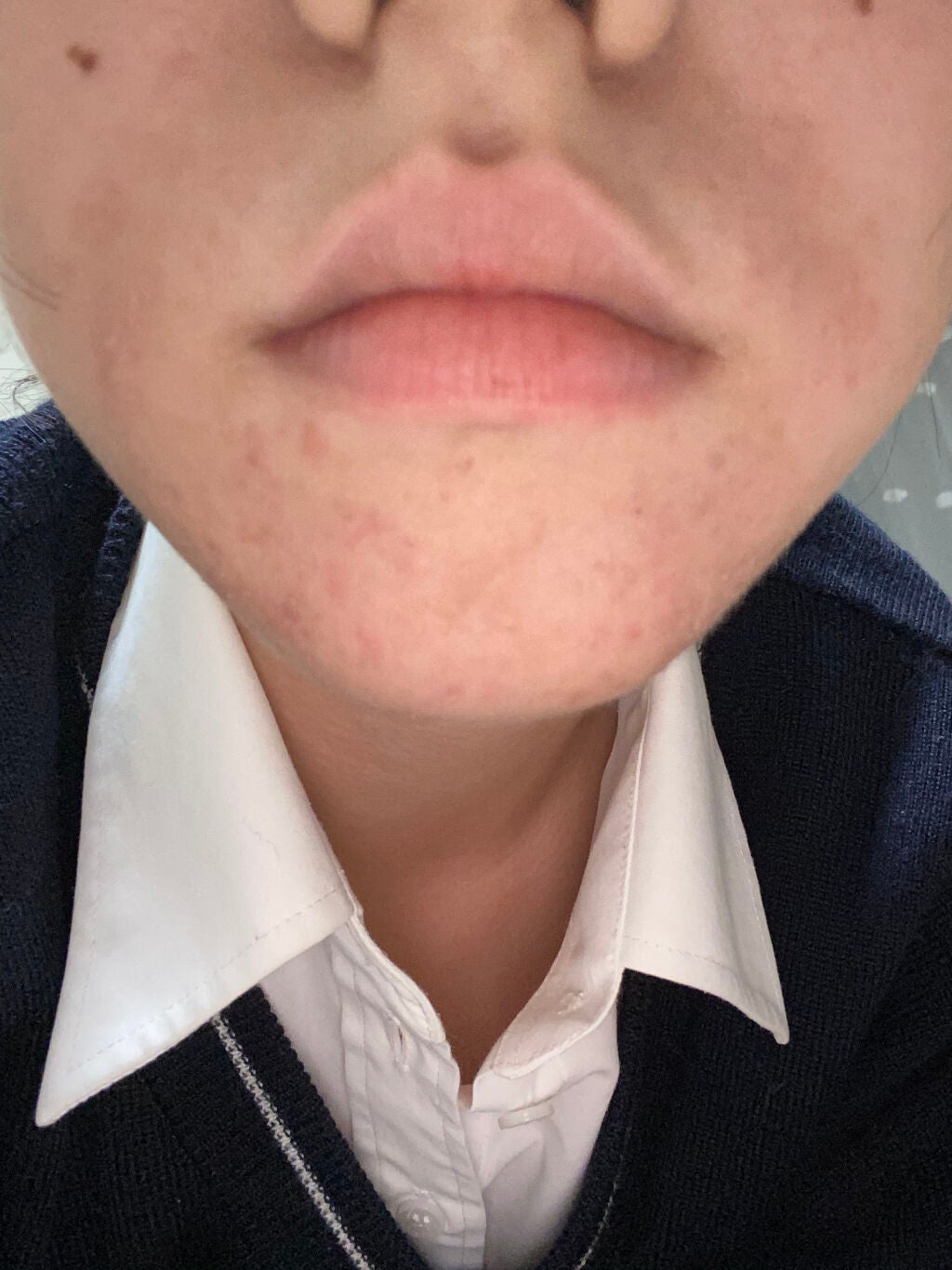 aya on LIPS 「4枚目閲覧注意です💦お久しぶりです!あやです!べピオゲル使い始..」(3枚目)