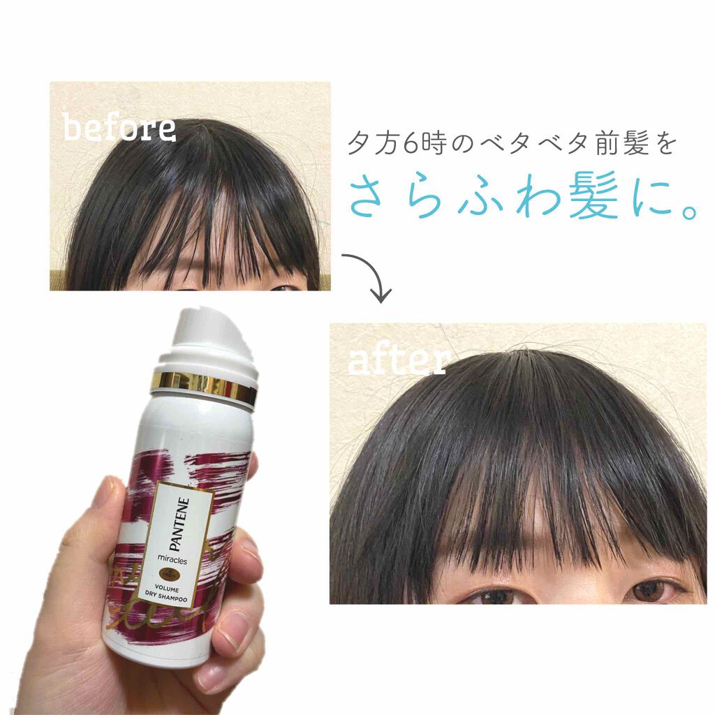 しましま On Lips 前髪ベタつき族に朗報 今までありそうでなかった神アイテムが新 Lips