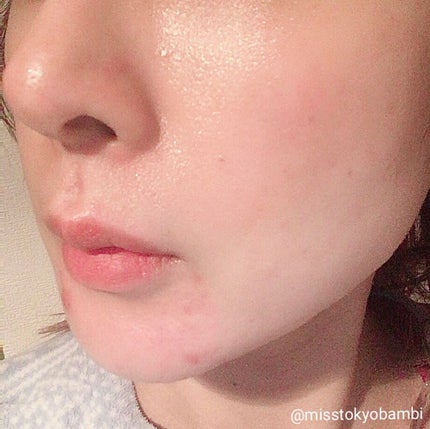 ドクタージャルト シェイキング ラバー シェイク&ショット/Dr.Jart+/シートマスク・パックを使ったクチコミ(8枚目)