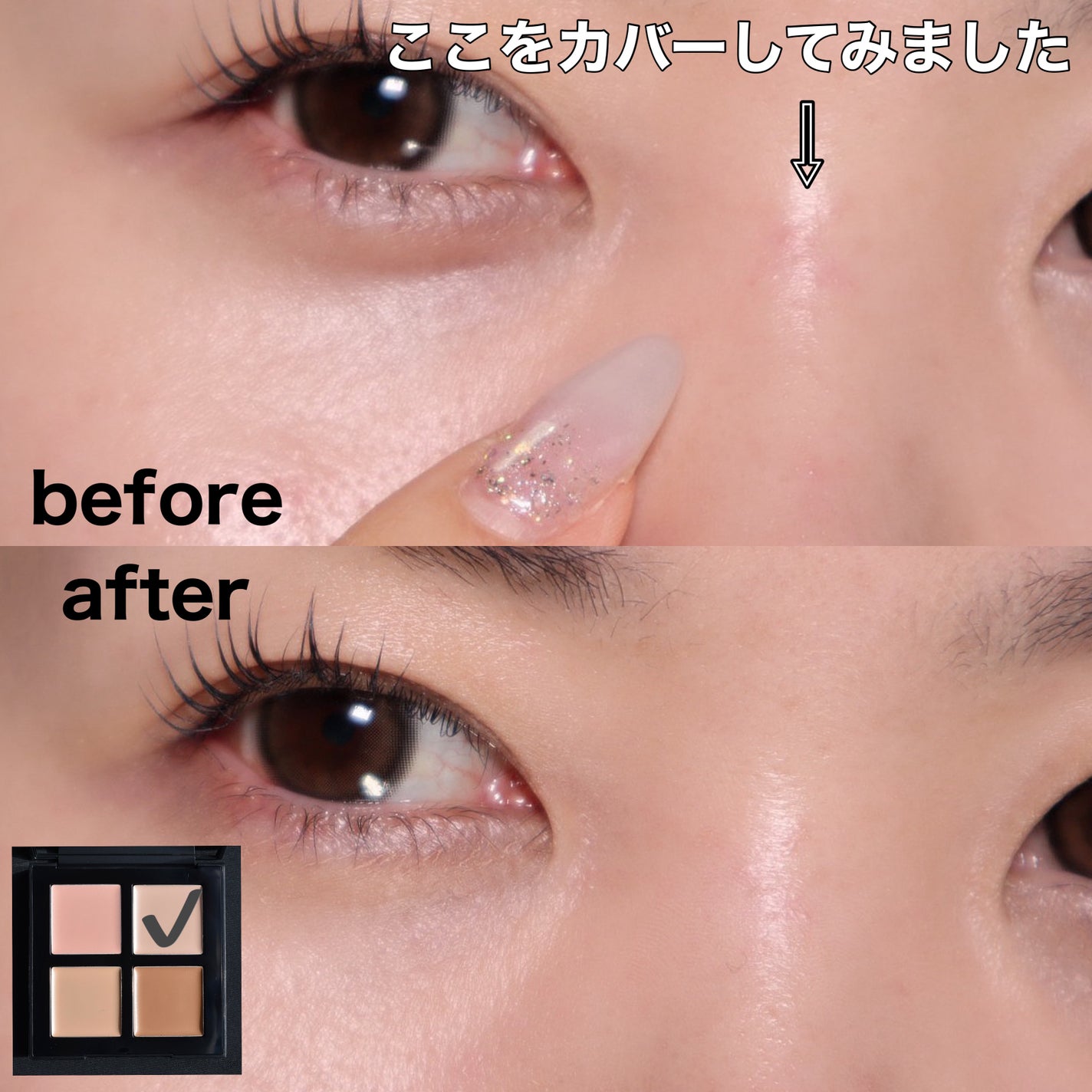 アンリミテッド CCC クワッド コンシーラー/shu uemura/パレットコンシーラーを使ったクチコミ(10枚目)