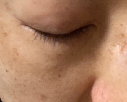 スキンリフレクト フレッシュ コンシーラー/ADDICTION/パレットコンシーラーを使ったクチコミ(3枚目)