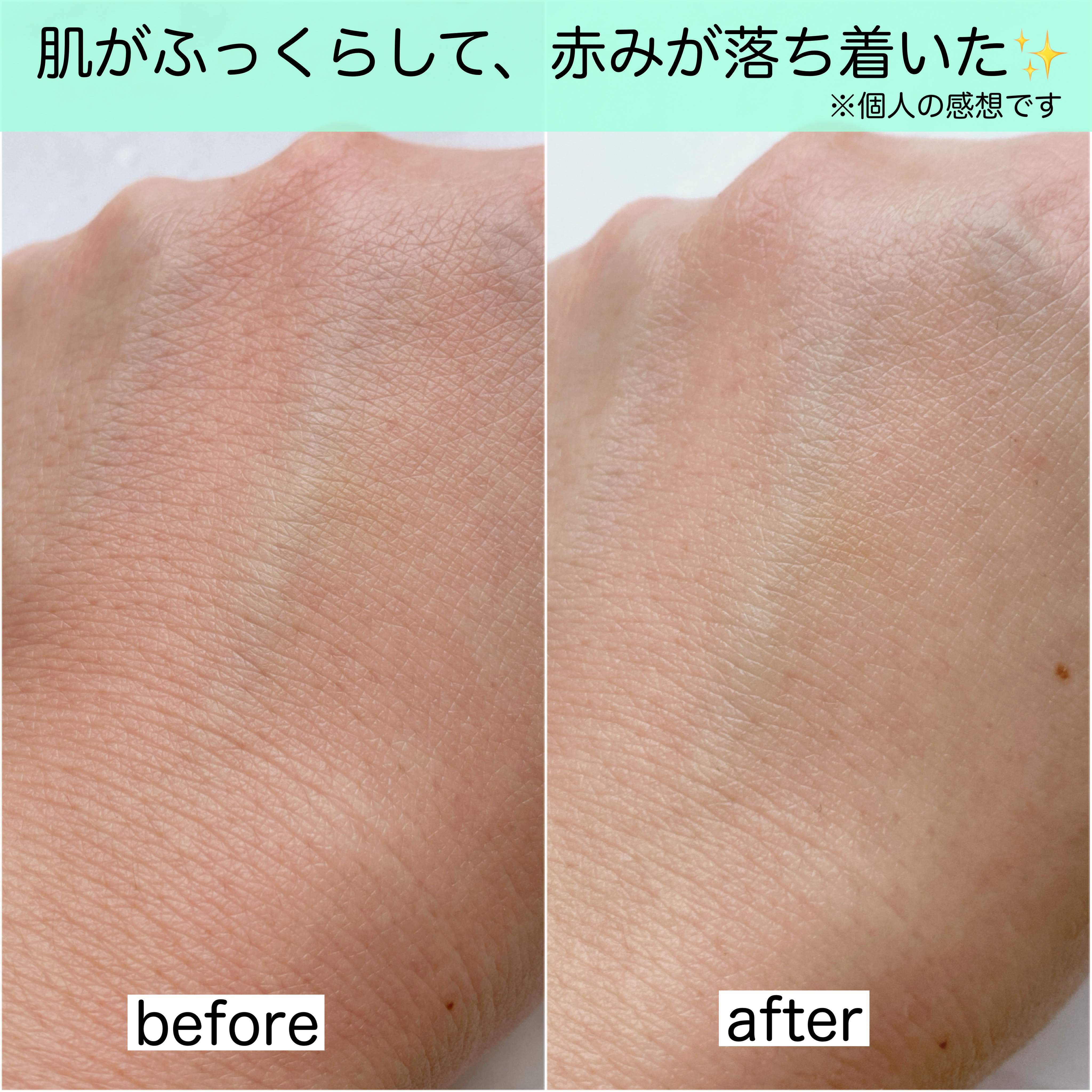 ニュートロジーナ®ノルウェー フォーミュラ インテンスリペア CICA 高保湿クリーム/Neutrogena/フェイスクリームを使ったクチコミ（3枚目）