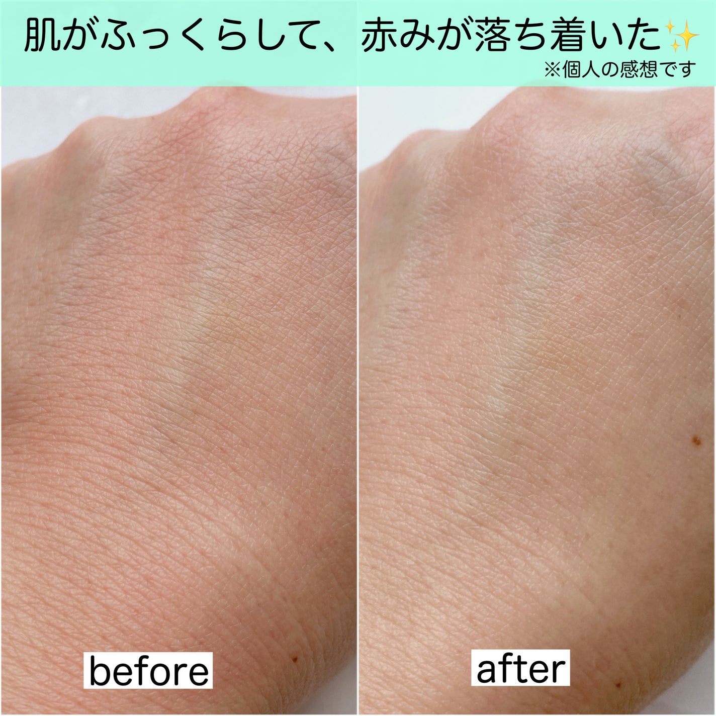 ニュートロジーナ®ノルウェー フォーミュラ インテンスリペア CICA 高保湿クリーム/Neutrogena/フェイスクリームを使ったクチコミ(3枚目)