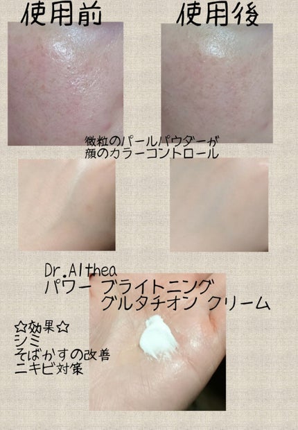 パワーブライトニング グルタチオンクリーム/Dr.Althea/フェイスクリームを使ったクチコミ(2枚目)