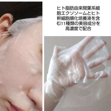 うるね温泉水フェイスマスク/Ulune/シートマスク・パックを使ったクチコミ（2枚目）