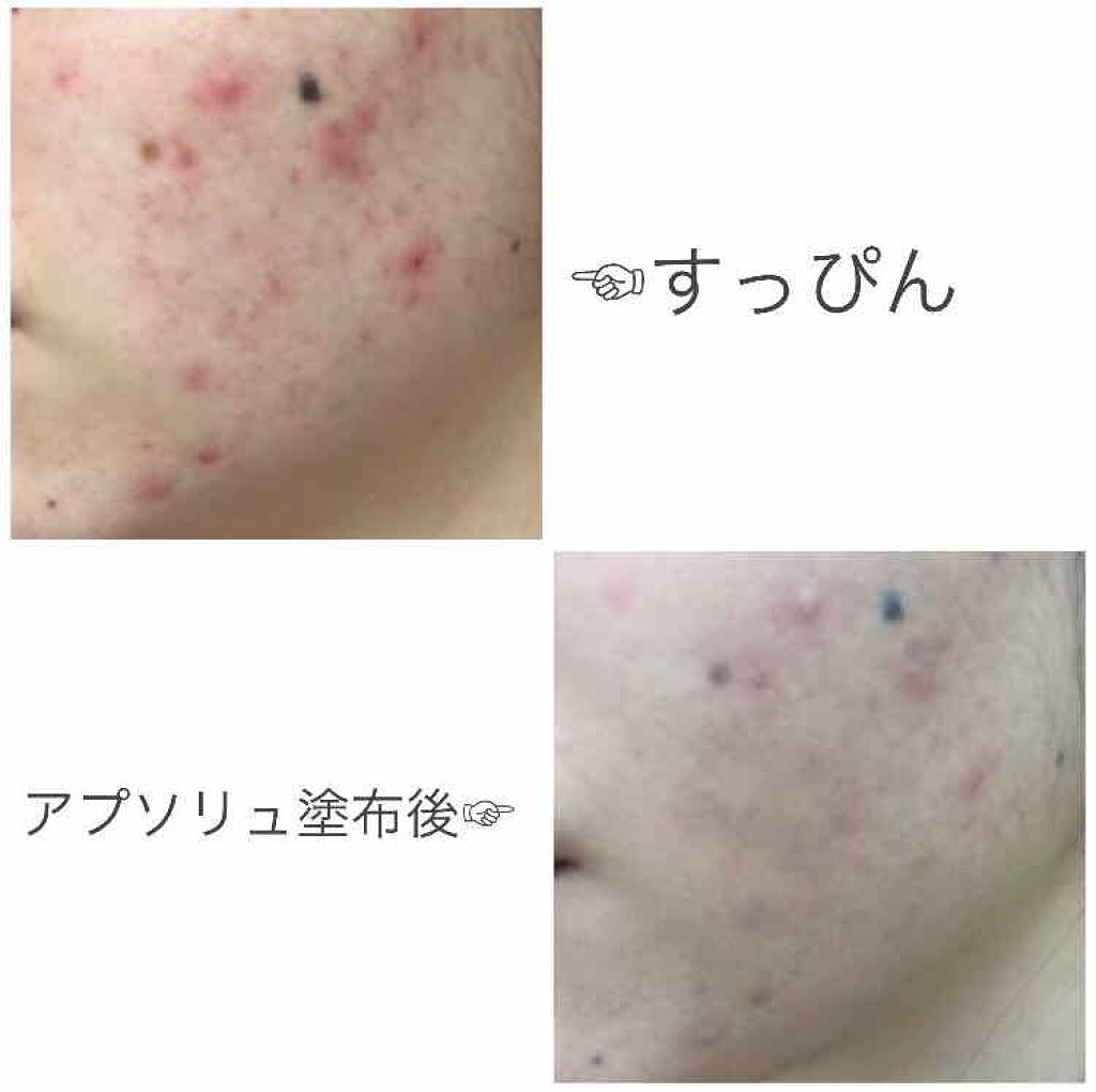 ブラン エクスペール クッションコンパクト H/LANCOME/クッションファンデーションを使ったクチコミ(3枚目)