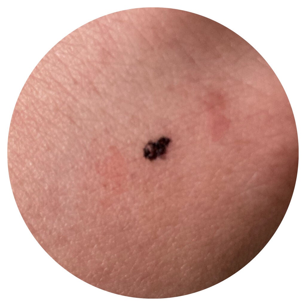 カバーパーフェクション チップコンシーラー/the SAEM/リキッドコンシーラーを使ったクチコミ(2枚目)