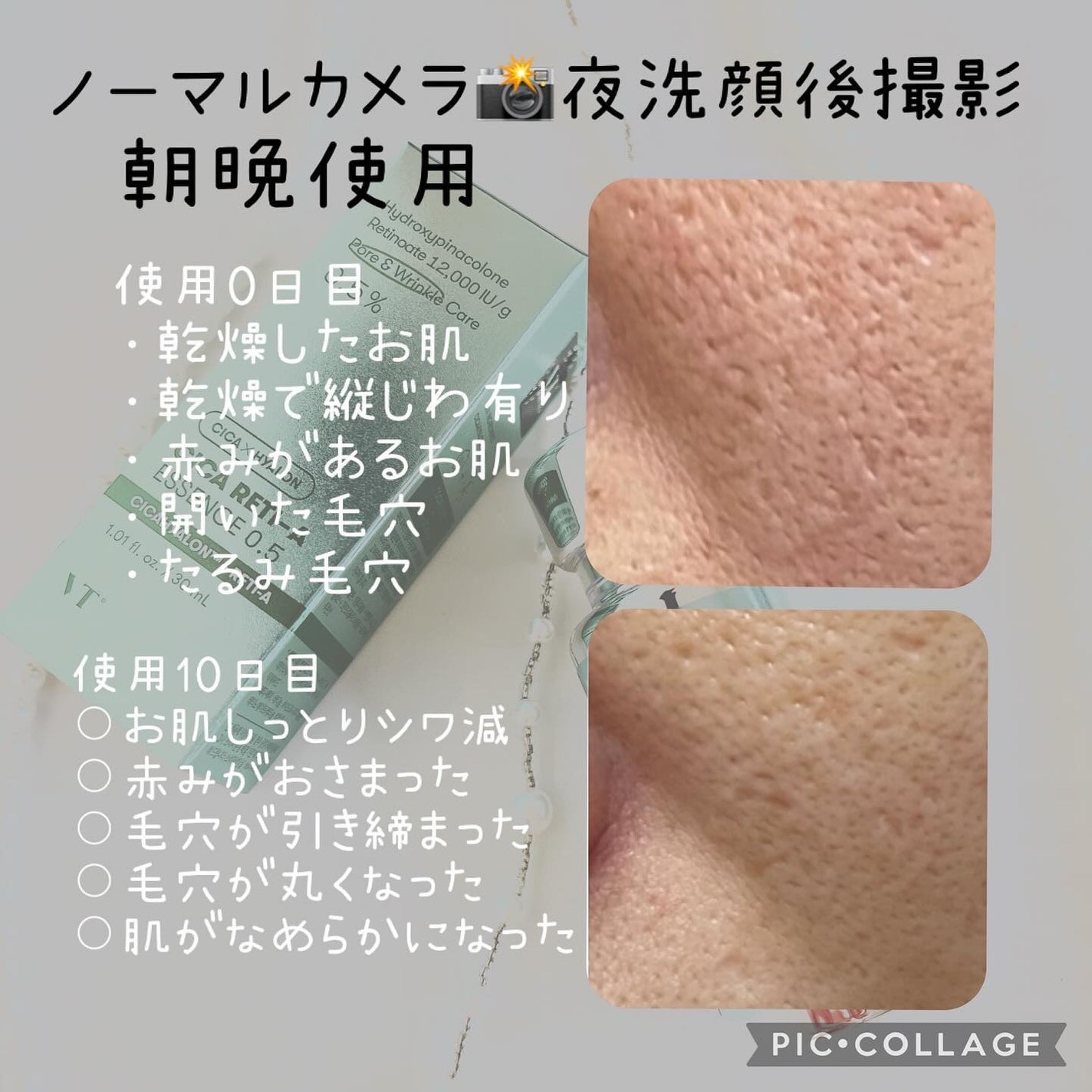 シカレチA エッセンス0.5/VT/美容液を使ったクチコミ(1枚目)