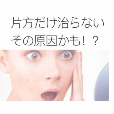 あげ直しです


片側だけ片頬だけ…
なかなかニキビが治らない…そんな方いませんか

はい。私です
なぜか右側だけずっと肌荒れし続けている私なりに研究した結果をまとめました！

なぜ？