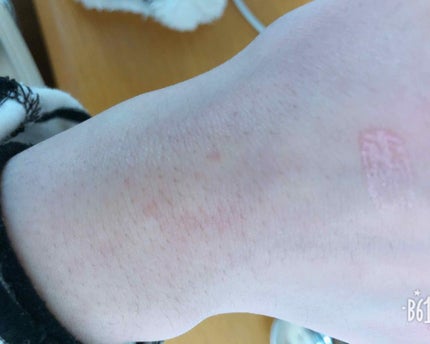 【旧】ディオール アディクト リップ マキシマイザー/Dior/リップグロスを使ったクチコミ(2枚目)