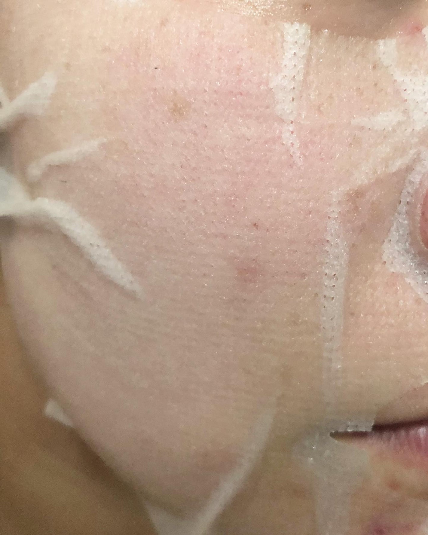 ビタペアC集中美容液シートマスク/ネイチャーリパブリック/シートマスク・パックを使ったクチコミ(6枚目)