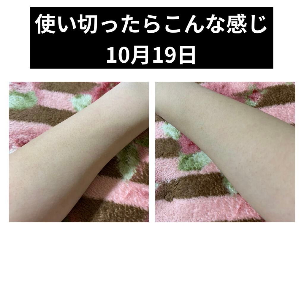 ニノキュア(医薬品)/ニノキュア/その他を使ったクチコミ(3枚目)