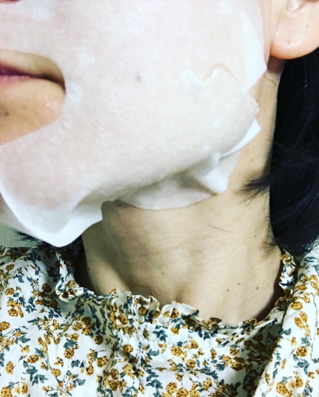 モイストフェイシャルパック/リバイシス/シートマスク・パックを使ったクチコミ(9枚目)