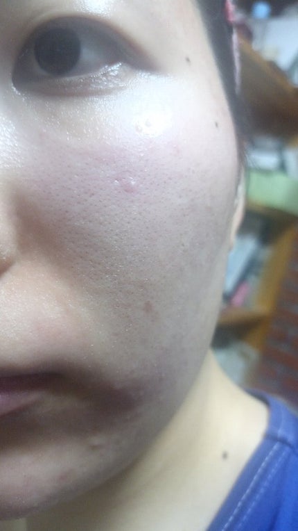 ブライトニングケア ローション M(医薬部外品)/アクアレーベル/化粧水を使ったクチコミ(4枚目)