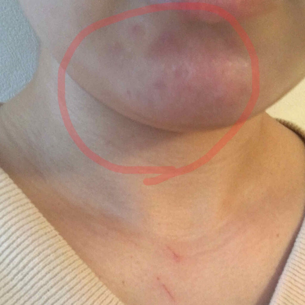 アズこ on LIPS 「!画像閲覧注意!!文章のみでもOKです!こんにちは😃前回の投稿..」(3枚目)