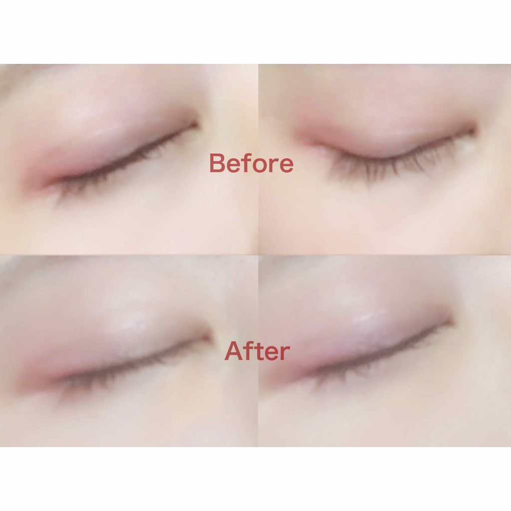 アイゾーンコンシーラー/コフレドール/スティックコンシーラーを使ったクチコミ(2枚目)