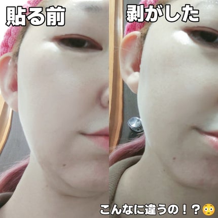 9番 NMNバイオリフトラッピングマスク/numbuzin/シートマスク・パックを使ったクチコミ(6枚目)