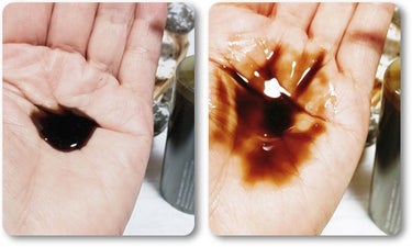 プロヘマチン原液 ヒト幹細胞培養エキス＋/fracora/洗い流すヘアトリートメントを使ったクチコミ（4枚目）