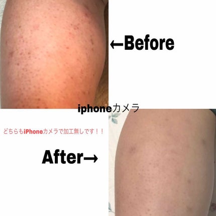 ハトムギ化粧水(ナチュリエ スキンコンディショナー R )/ナチュリエ/化粧水を使ったクチコミ(2枚目)