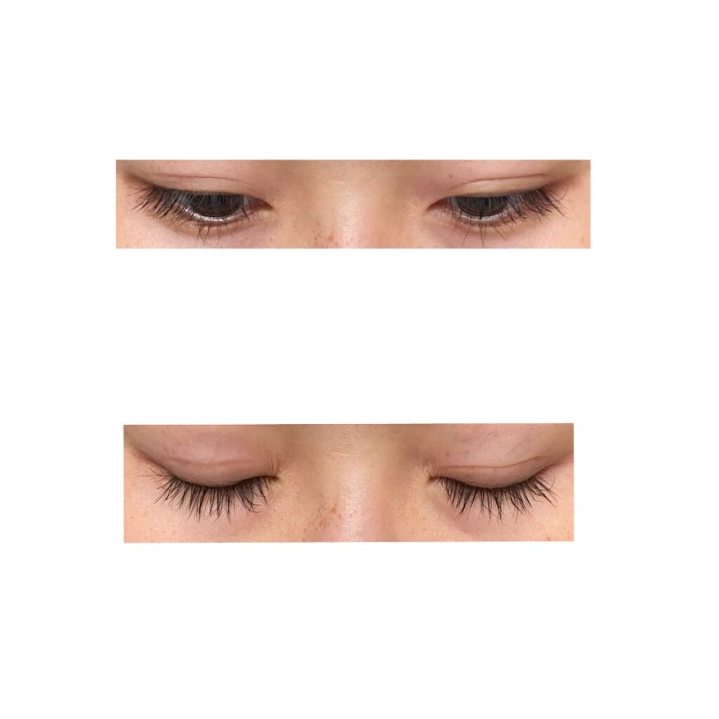 フリーファイバー120 スタンダードタイプ /メザイク/二重まぶた用アイテムを使ったクチコミ(3枚目)