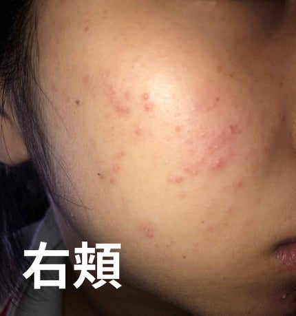 ハトムギ化粧水(ナチュリエ スキンコンディショナー R )/ナチュリエ/化粧水を使ったクチコミ(4枚目)