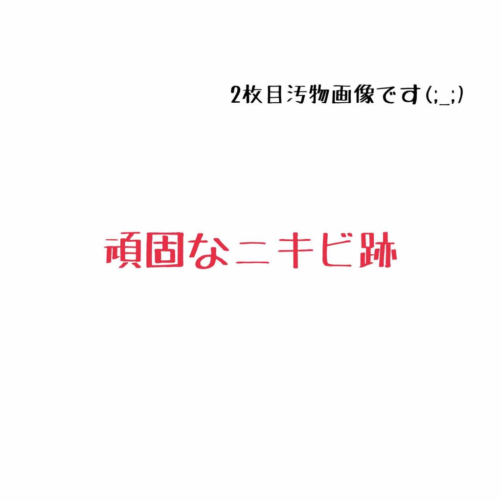 乳液・敏感肌用・しっとりタイプ/無印良品/乳液を使ったクチコミ（1枚目）
