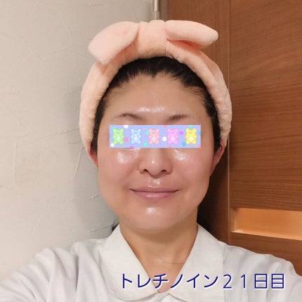 トレチノインジェル/A-Ret/美容液を使ったクチコミ(1枚目)