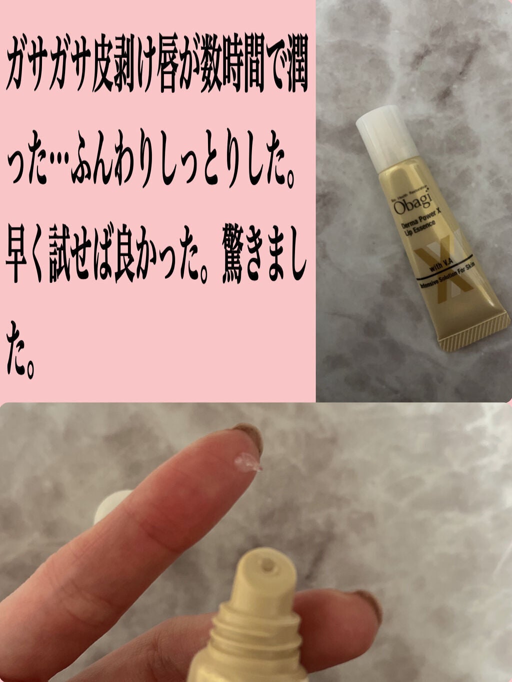 ダーマパワーX リップエッセンス/オバジ/リップ美容液を使ったクチコミ(2枚目)