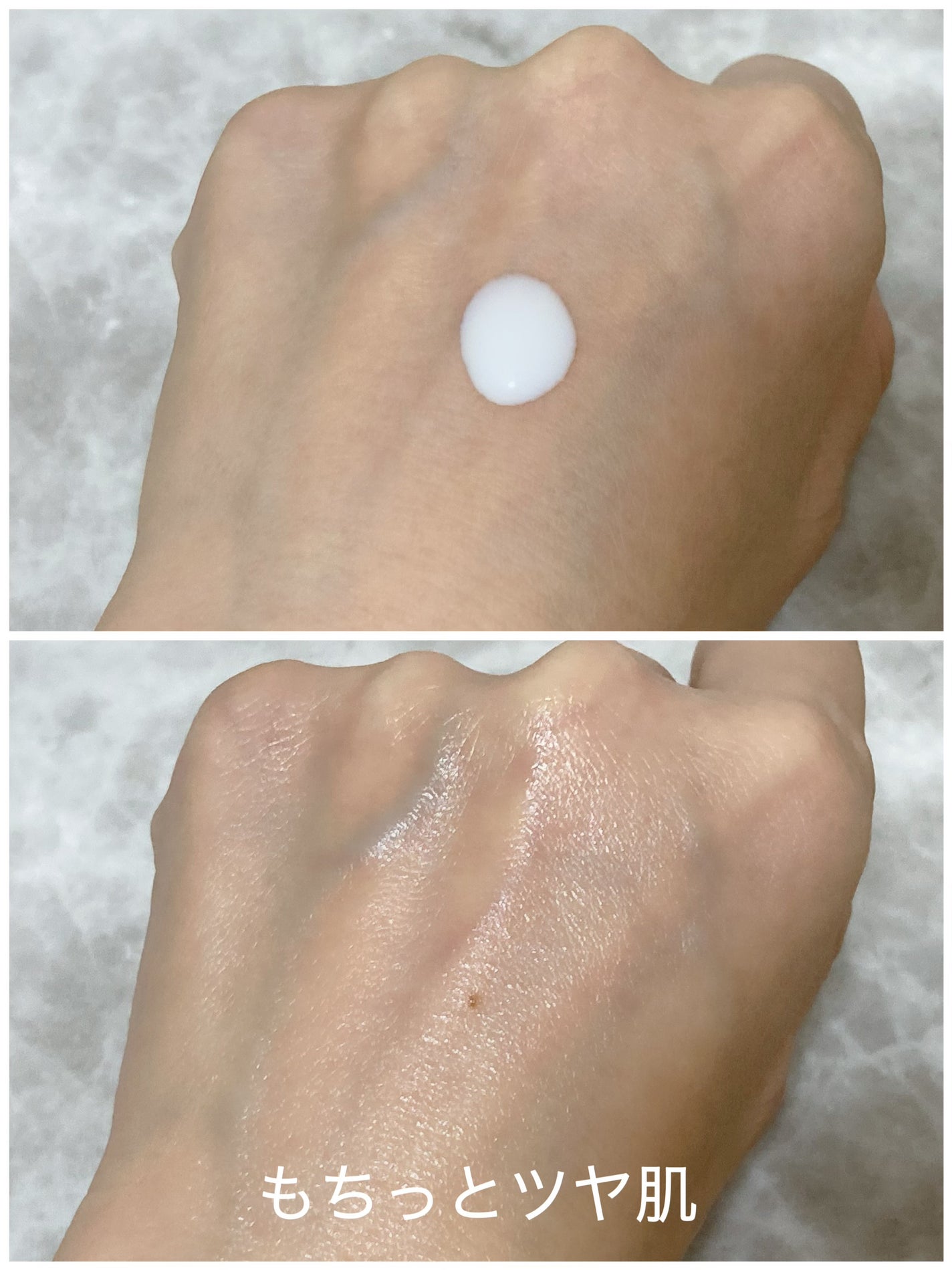 リードルショット300/VT/美容液を使ったクチコミ(5枚目)