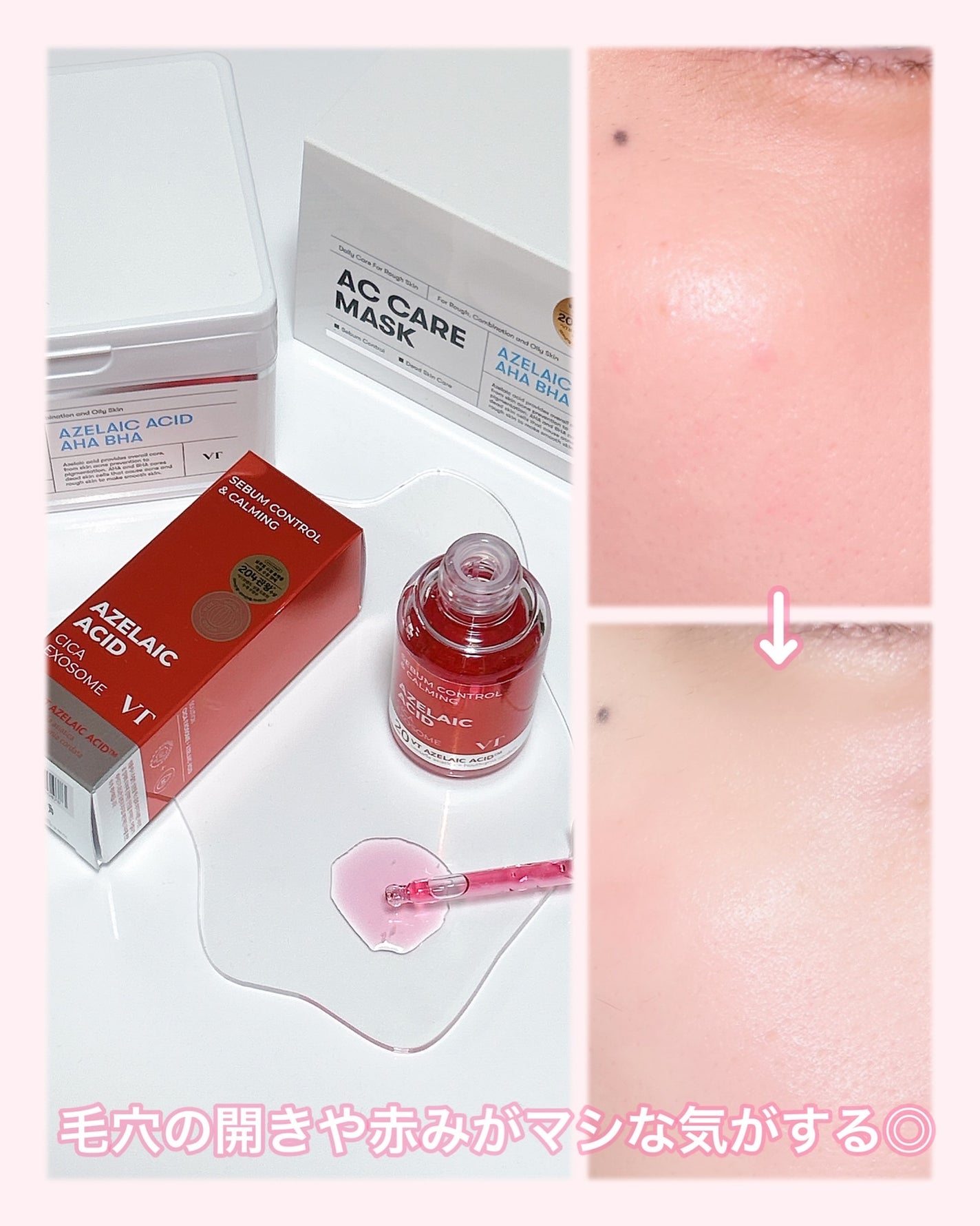 AZケア マスク/VT/シートマスク・パックを使ったクチコミ(4枚目)