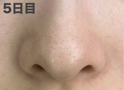 おうちdeエステ 肌をなめらかにするマッサージ洗顔ジェル 炭/ビオレ/その他洗顔料を使ったクチコミ(9枚目)