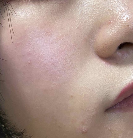 【旧品】マシュマロフィニッシュパウダー/キャンメイク/プレストパウダーを使ったクチコミ(4枚目)