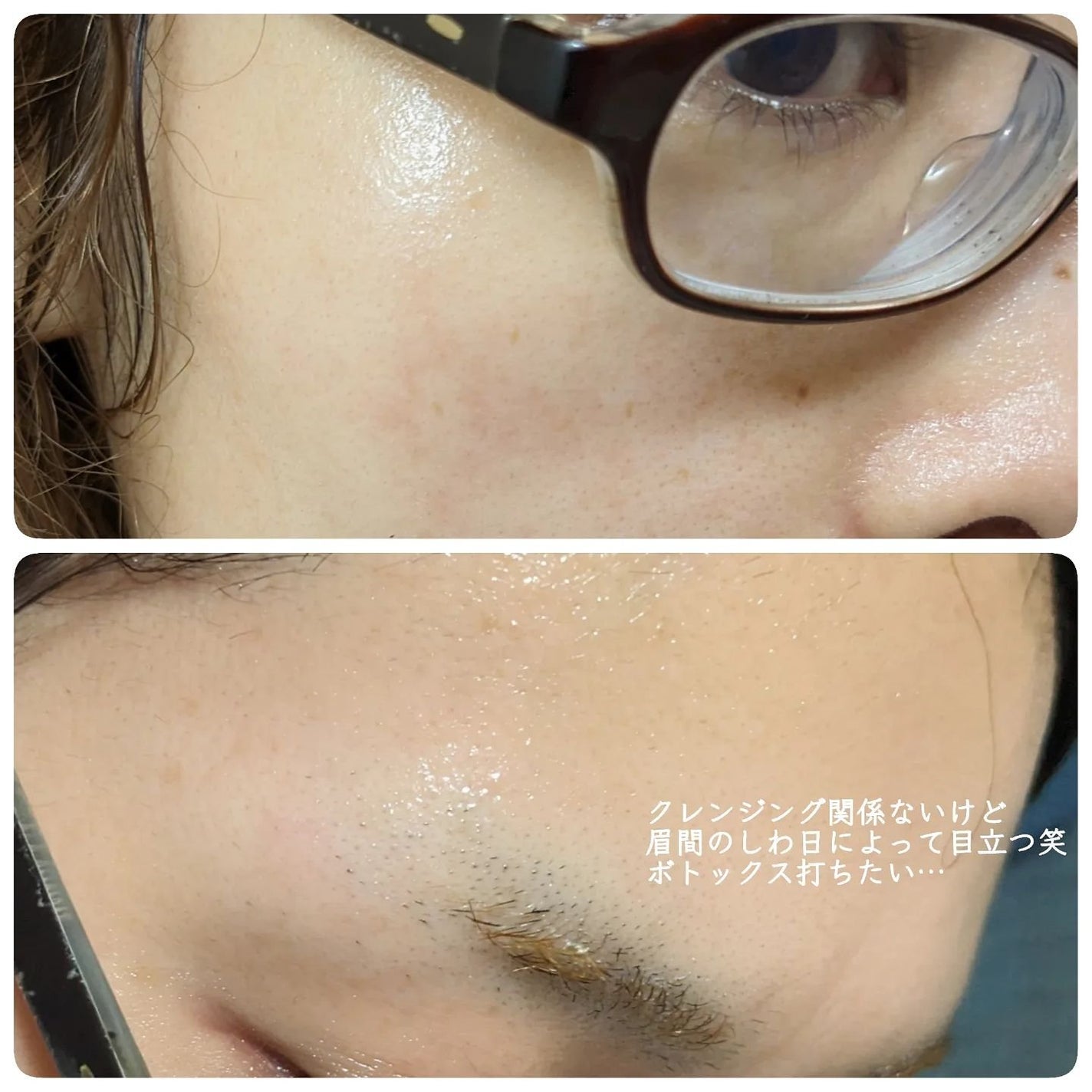 コンマス オン ライフ ブライトニング クレンジングバーム/Heart Percent/クレンジングバームを使ったクチコミ(5枚目)