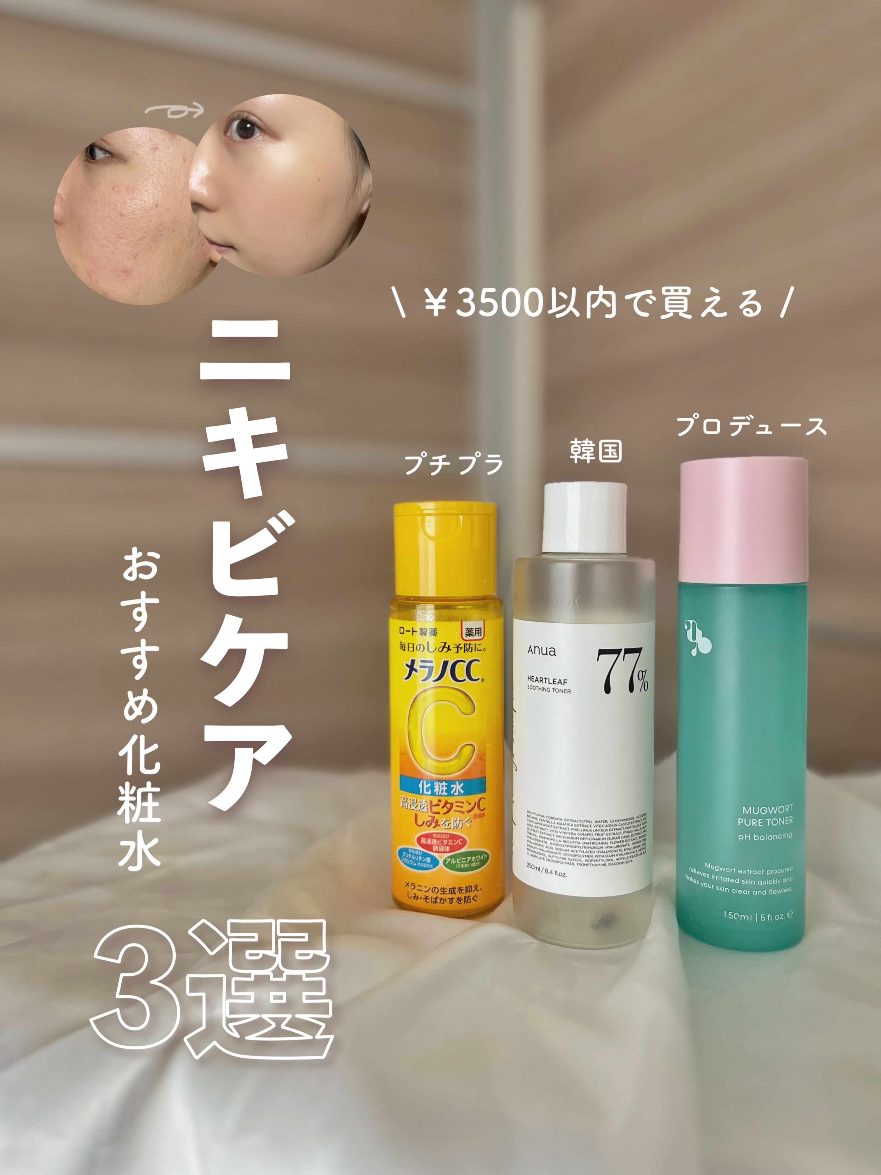 【3500円以内で買える】
ニキビにおすすめの化粧水3選‪🌱‬


Anua
ドクダミ77%スージングトナー
250ml / ￥2650

メラノCC
薬用シミ対策美白化粧水
[医薬部外品]
170ml / ￥990

megood be