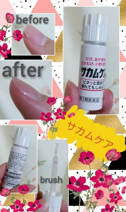 サカムケア(医薬品)/小林製薬/その他を使ったクチコミ(1枚目)