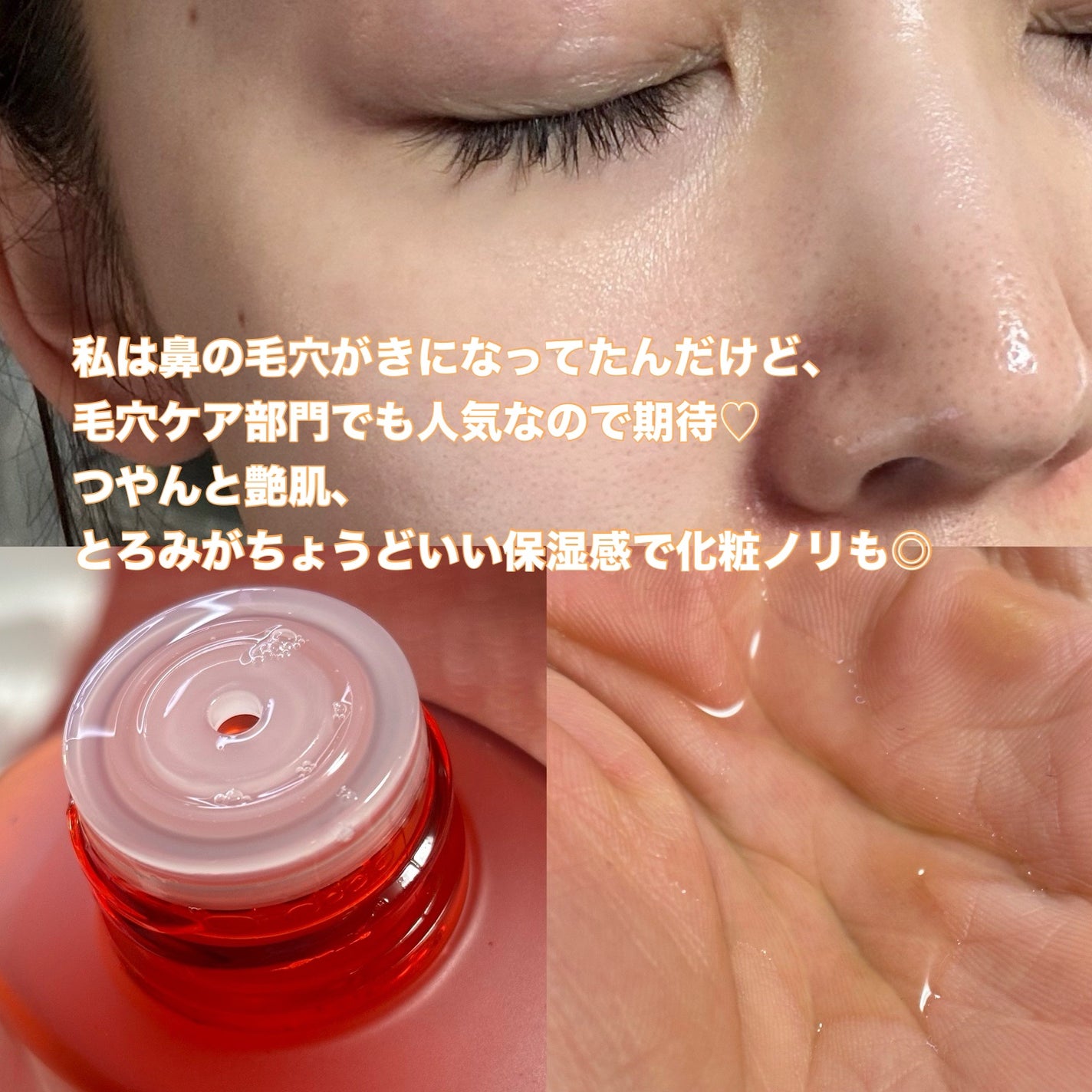 VC100エッセンスローション EX/ドクターシーラボⓇ/化粧水を使ったクチコミ(2枚目)