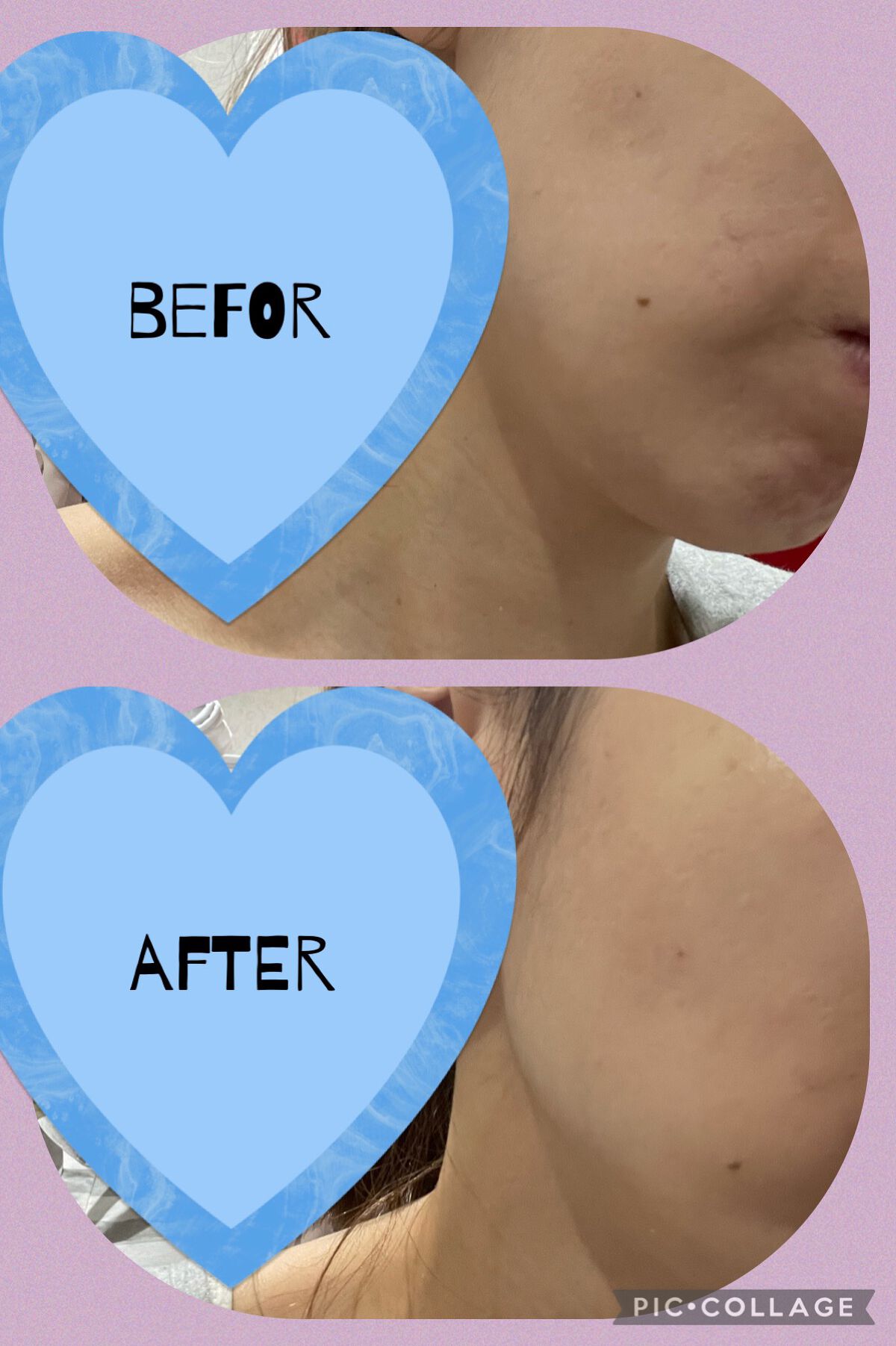 キル カバー フィクサー クッション/CLIO/クッションファンデーションを使ったクチコミ（3枚目）