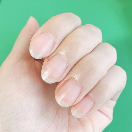 ポニキウムオイル/enieni /ネイルオイル・トリートメントを使ったクチコミ(4枚目)