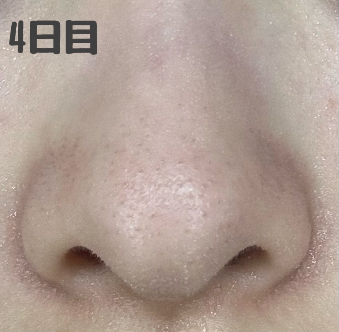 デュオ ザ クレンジングバーム ブラックリペア /DUO/クレンジングバームを使ったクチコミ(5枚目)