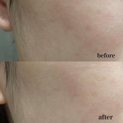 ラスト ミニット スキン レスキュー復活草マスク/Dr.Althea/シートマスク・パックを使ったクチコミ(5枚目)